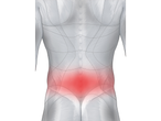 Illustration of lower back pain highlighting affected muscles.